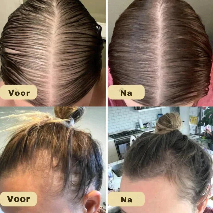 HairVitalize - Haargroei olie
