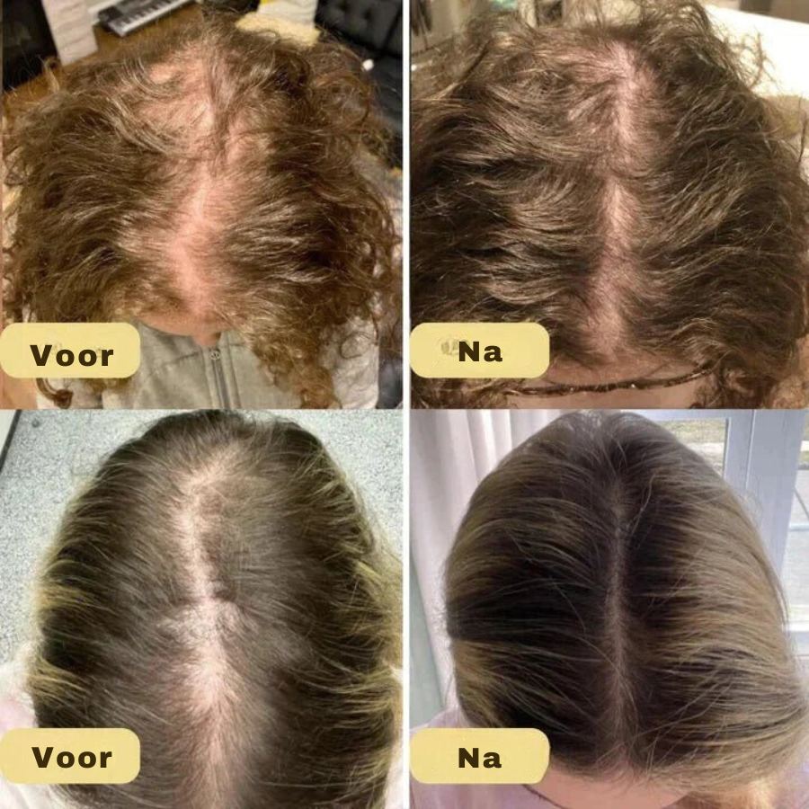 HairVitalize - Haargroei olie