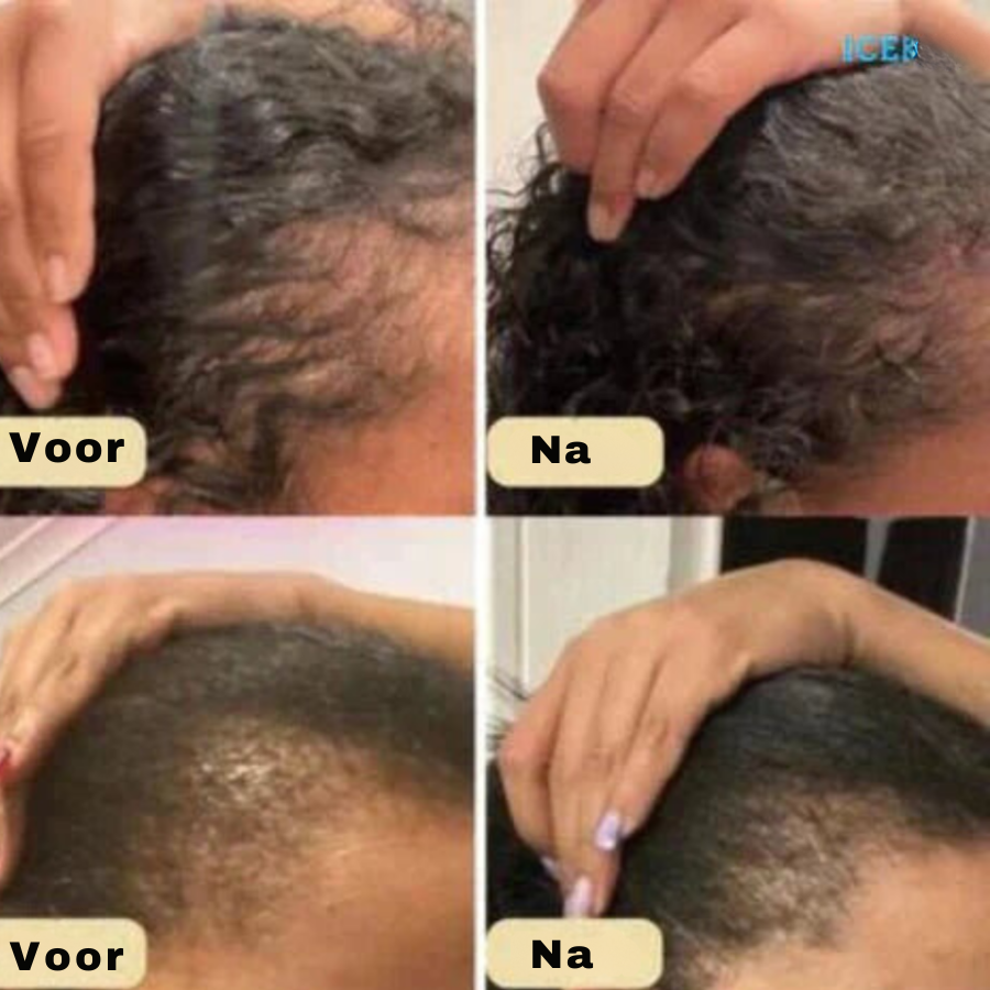 HairVitalize - Haargroei olie