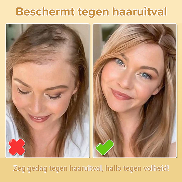 BioGrowth - Spray Voor Haargroei