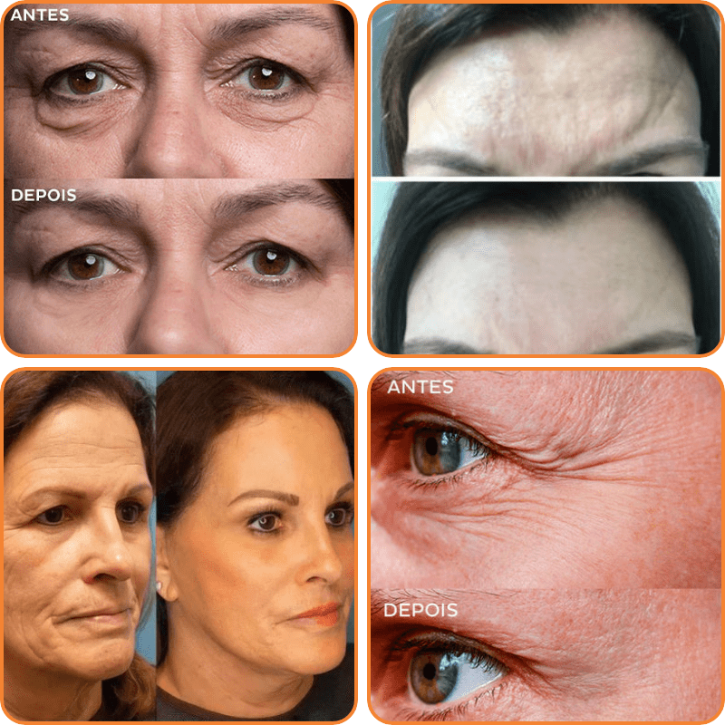 DermaVelle – Kollagén- és hialuronsavas arcmaszk