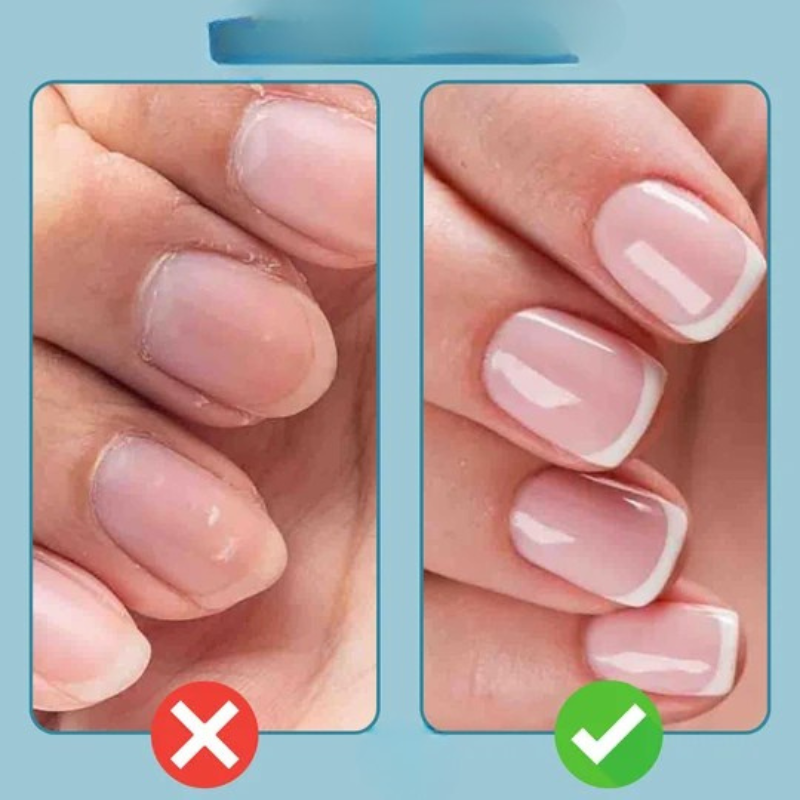 Oferta 1+1 grátis | Nailuxe - Caneta de óleo para cutículas 3 em 1